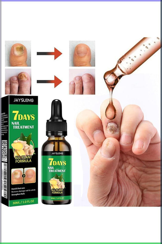 ¡Combate el hongo de las Uñas!